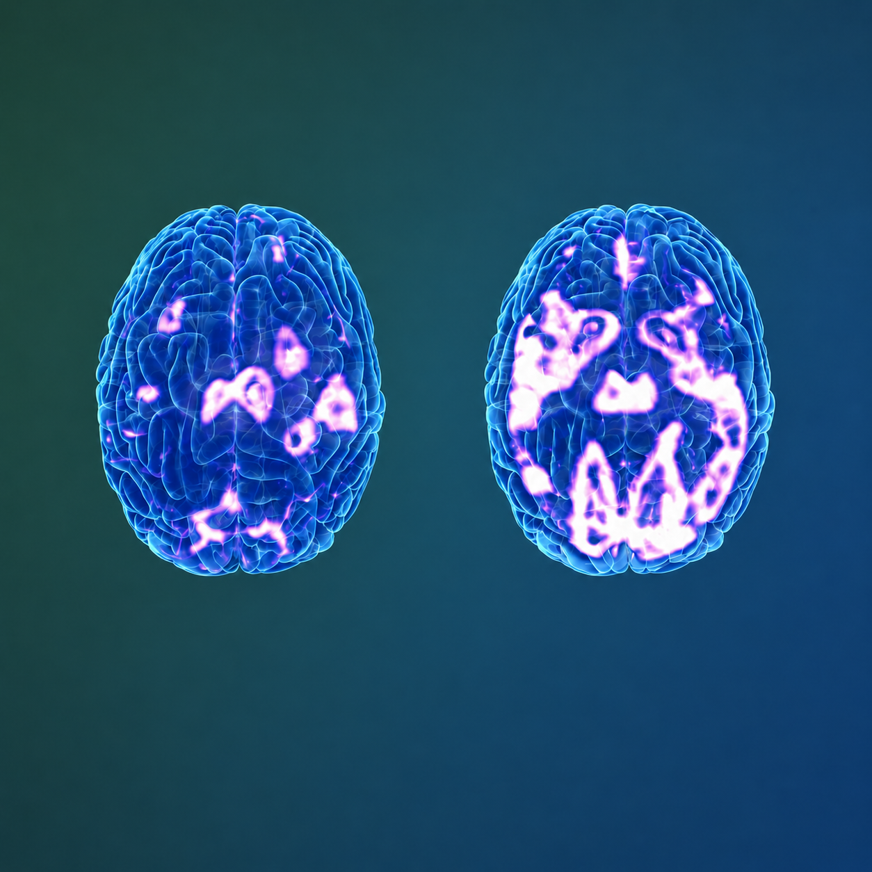 Example neural activity images shown before and after treatment
